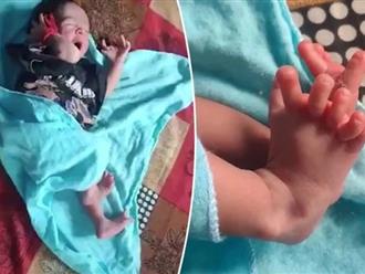 Kì lạ bé gái sinh ra với 26 ngón tay chân được coi như hóa thân của 'nữ thần' Hindu