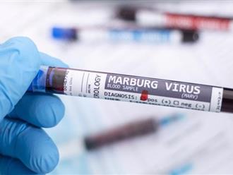Virus Marburg ngày càng lan rộng, chuyên gia cảnh báo nguy cơ dịch chồng dịch