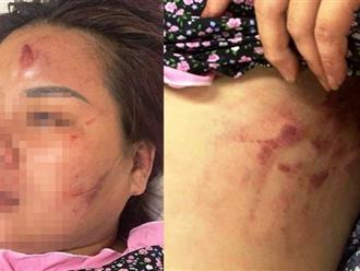 Luật sư tố cáo tội ác dã man của người chồng đánh vợ ở Đà Nẵng: Pháp không dung, đời không tha