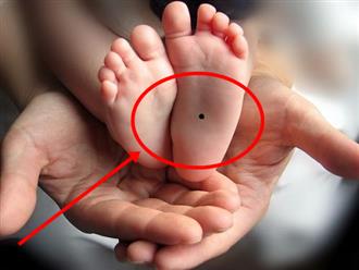 3 nốt ruồi báo hiệu thành công ở trẻ nhỏ: cha mẹ xem để biết bé có mệnh quý nhân hay không 