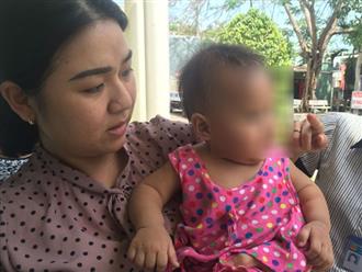 Nghi án bé gái 8 tháng tuổi bị người nhận nuôi đánh thâm tím khắp mình mẩy