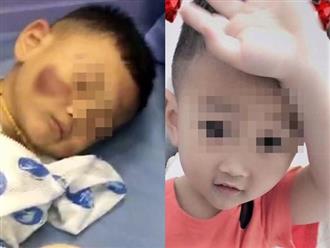 Bé 2 tuổi bị mẹ kế đánh đến tụ máu não, cha ruột giấu giếm: 'Vợ cấm tiết lộ với người khác'