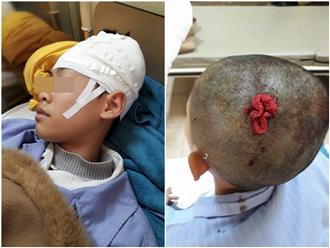 Quảng Ninh: Thầy giáo thể dục bị tố đánh học sinh tụ máu não, phải nhập viện phẫu thuật