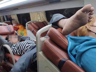 Hình ảnh 'bàn chân hư hỏng' trên xe khách lúc nửa đêm khiến dân mạng bức xúc