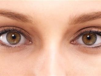 5 dấu hiệu ở mắt cảnh báo sự bất thường về sức khoẻ của bạn