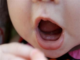 Bé mọc răng chậm cha mẹ nên xử trí thế nào?