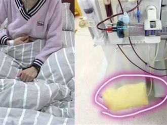Cô gái 28 tuổi cấp cứu trong tình trạng máu vàng như "mỡ", viêm tụy cấp nặng vì thói quen ăn uống nhiều người trẻ vẫn làm