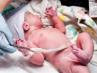 Lưu trữ tế bào gốc cuống rốn của bé ngay sau khi chào đời là gì?