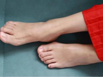 Người sở hữu cơ thể trẻ khỏe theo thời gian sẽ không có 3 biểu hiện này ở bàn chân