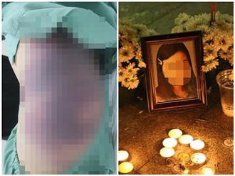 Báo cáo của UBND quận Bình Thạnh về vụ bé gái 8 tuổi bị hành hạ tử vong: Nạn nhân bị gãy khung xương sườn, tụ máu, phù não