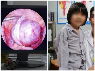 Cực hiếm: Bé gái bị u nang buồng trứng xoắn khi mới 7 tuổi