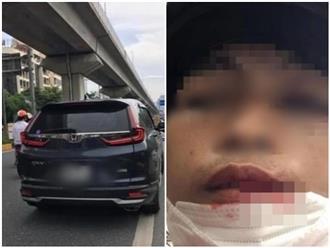 Vụ tài xế xe ôm công nghệ nghi bị người lái ô tô đánh vì 'không nhường đường': Cơ quan chức năng vào cuộc xác minh