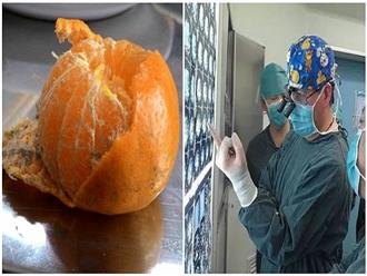 Những loại quả ‘siêu ngon’ người Việt ‘siêu thích’ lại là khắc tinh của căn bệnh ung thư gan nguy hiểm