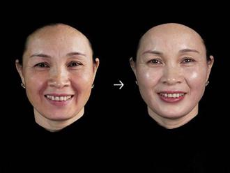 5 thói quen nên thiết lập sớm để ngăn da mặt, da cổ bị chảy xệ