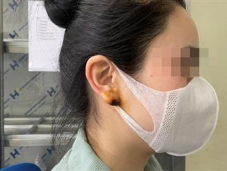 Lào Cai: Gặp biến chứng vì cấy chỉ nâng mũi và tiêm filler "tai Phật" cầu tài lộc