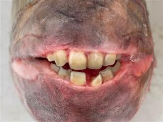 Người đàn ông thích thú khi bắt được con cá 7,5kg, nhưng bất ngờ hơn nó có hàm răng giống con người