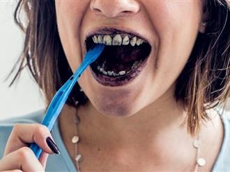 6 cách tẩy trắng răng trắng sáng tại nhà nhất định bạn phải thử ngay