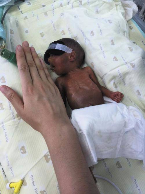 Bé sinh non 24 tuần 550gr, hình ảnh sau 5 tháng nuôi gây “ngã ngửa” vì trở thành mũm mĩm - Ảnh 1