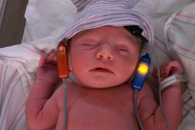 Đây là lý do bác sĩ khuyến nghị mọi đứa trẻ nên được kiểm tra thính lực ngay khi chào đời - Ảnh 2