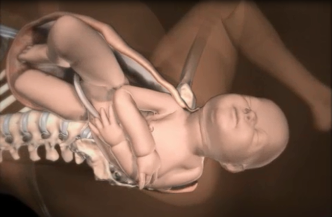 Những điều các mẹ cần biết về tình huống đẻ khó do bé bị kẹt vai trong lúc sinh thường - Ảnh 5