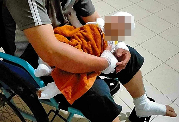 Ném 'bom xăng' vào nhà dân khiến 3 người bị thương: Bé trai 4 tháng tuổi bị bỏng nặng - Ảnh 1