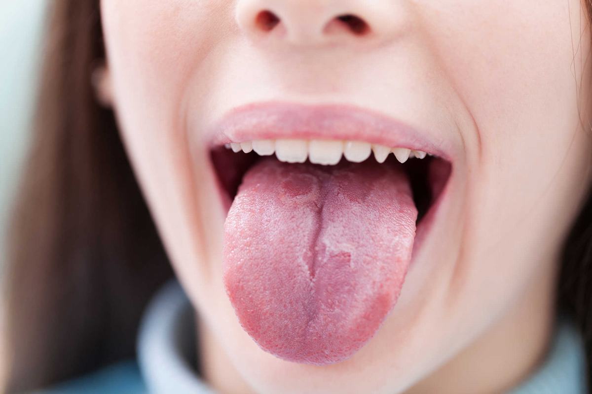 Những biểu hiện của lưỡi 'tố' tình trạng sức khỏe của bạn đang gặp vấn đề: Thấy 1 thay đổi nhỏ cũng gặp bác sĩ ngay kẻo bệnh càng thêm nặng - Ảnh 1