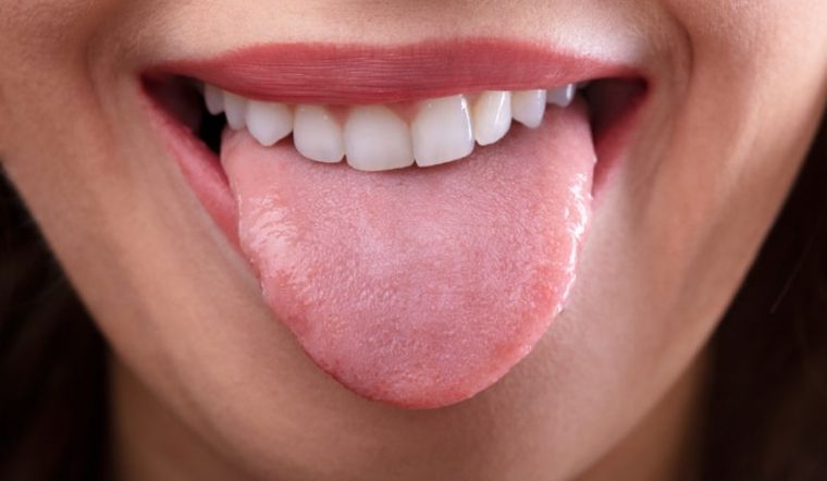 Những biểu hiện của lưỡi 'tố' tình trạng sức khỏe của bạn đang gặp vấn đề: Thấy 1 thay đổi nhỏ cũng gặp bác sĩ ngay kẻo bệnh càng thêm nặng - Ảnh 2