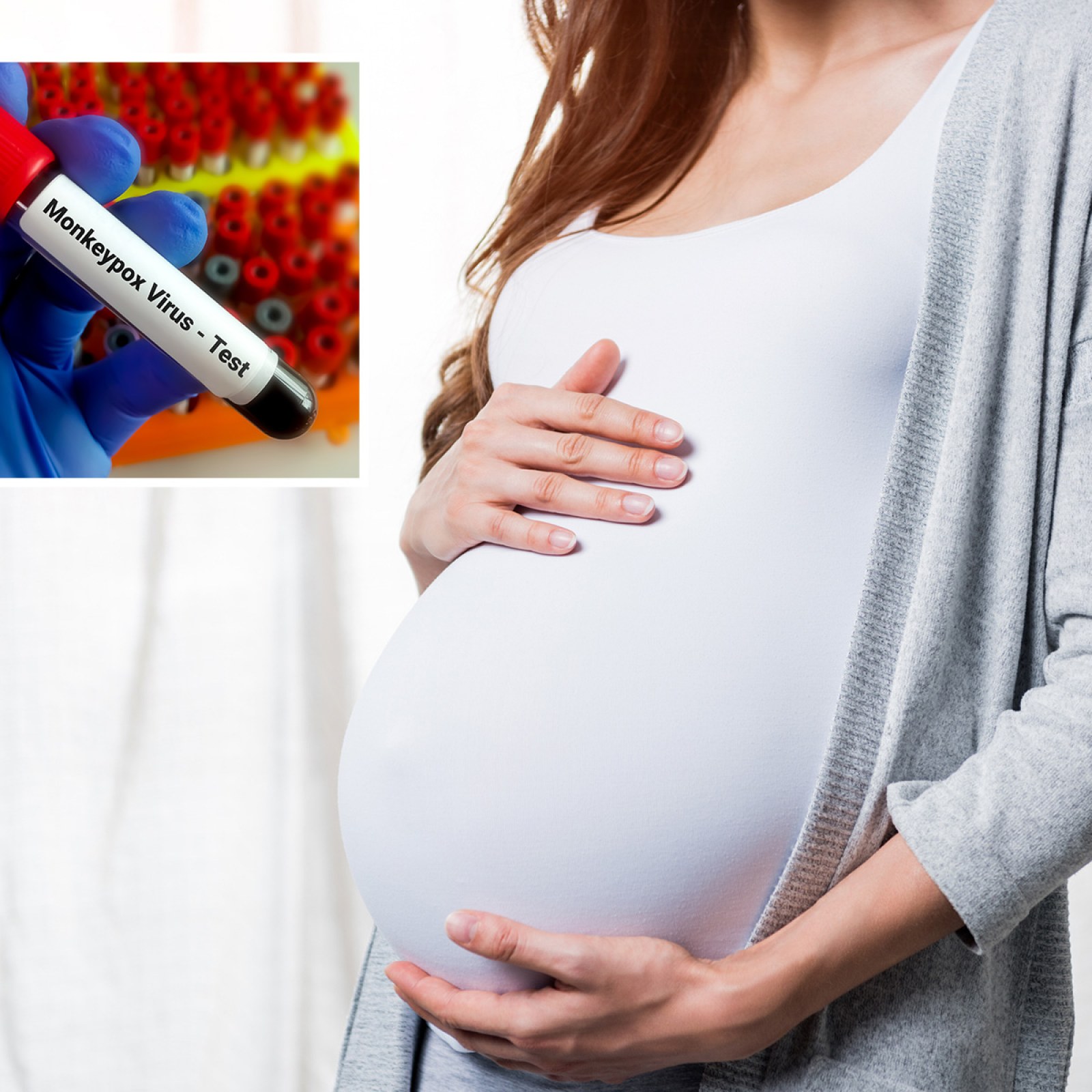 Nhiễm bệnh đậu mùa khỉ trong thai kỳ có thể gây nguy hiểm cho thai nhi, bác sĩ khuyến cáo mẹ bầu đặc biệt lưu tâm - Ảnh 1