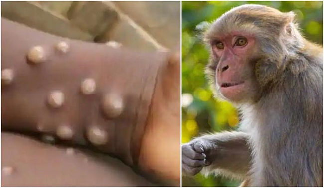 Việt Nam ghi nhận 4 ca mắc đậu mùa khỉ, WHO khuyến cáo đặc biệt về cách phòng ngừa bệnh lan truyền - Ảnh 1