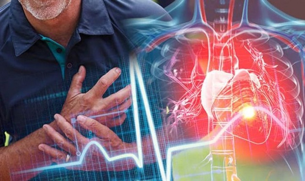 Đau ngực, tức thở thường xuyên có thể cảnh báo cơn đau tim đang đe dọa sức khỏe - Ảnh 4