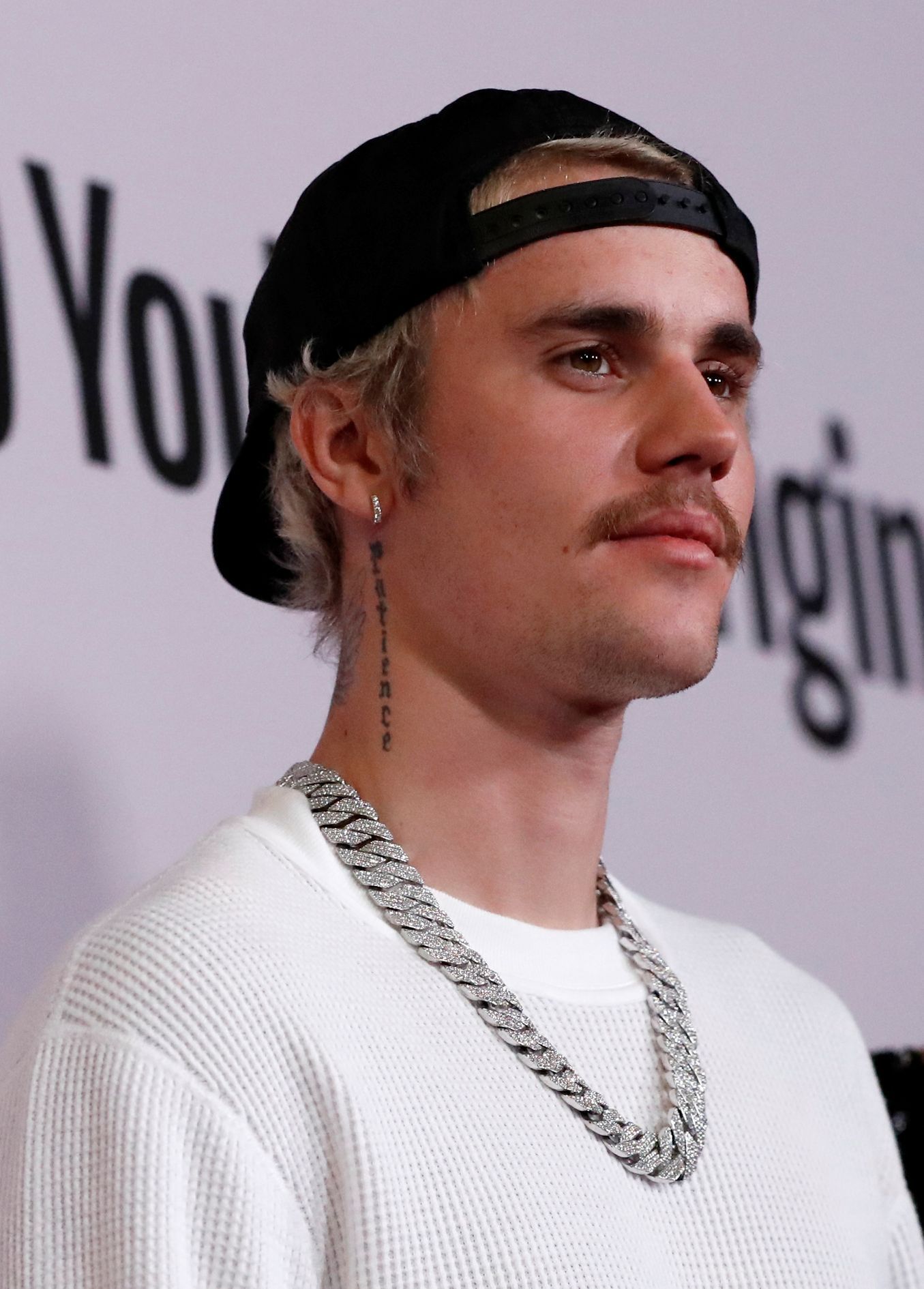 Sau 6 tuần điều trị bệnh liệt cơ mặt, nam ngôi sao Justin Bieber giờ ra sao? - Ảnh 2