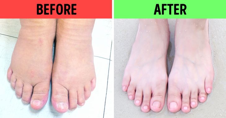 Ngâm chân theo cách này không chỉ giảm đau nhức hiệu quả mà còn khử sạch mùi hôi và mang lại làn da mịn màng cho bạn - Ảnh 1