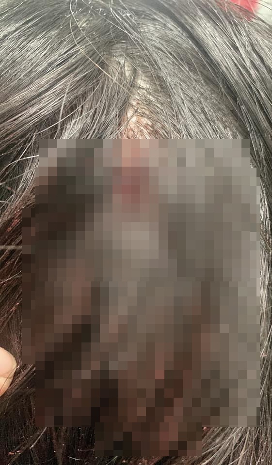Hoa hậu Oanh Lê tố bị đánh tại công an phường: Công an vào cuộc điều tra - Ảnh 2