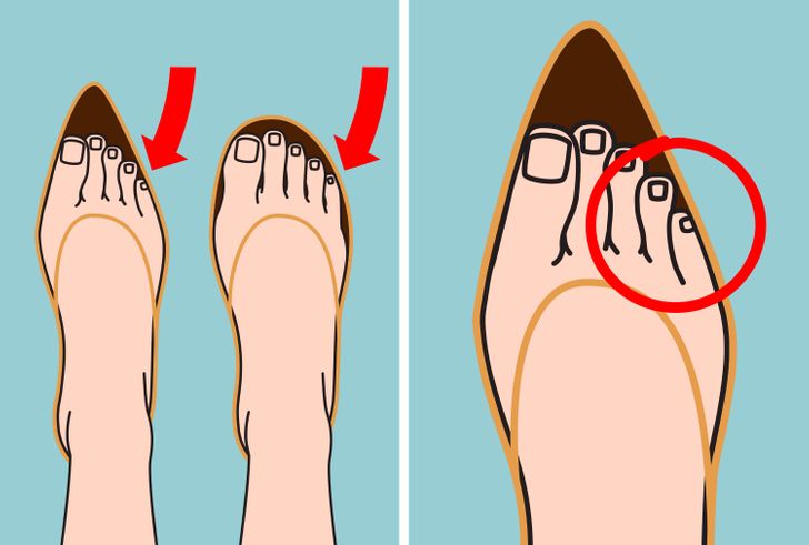 Đi giày cao gót mỗi ngày: Thói quen gây mòn sụn đĩa đệm, áp lực 'kinh hoàng' lên đầu gối và mắt cá chân  - Ảnh 6