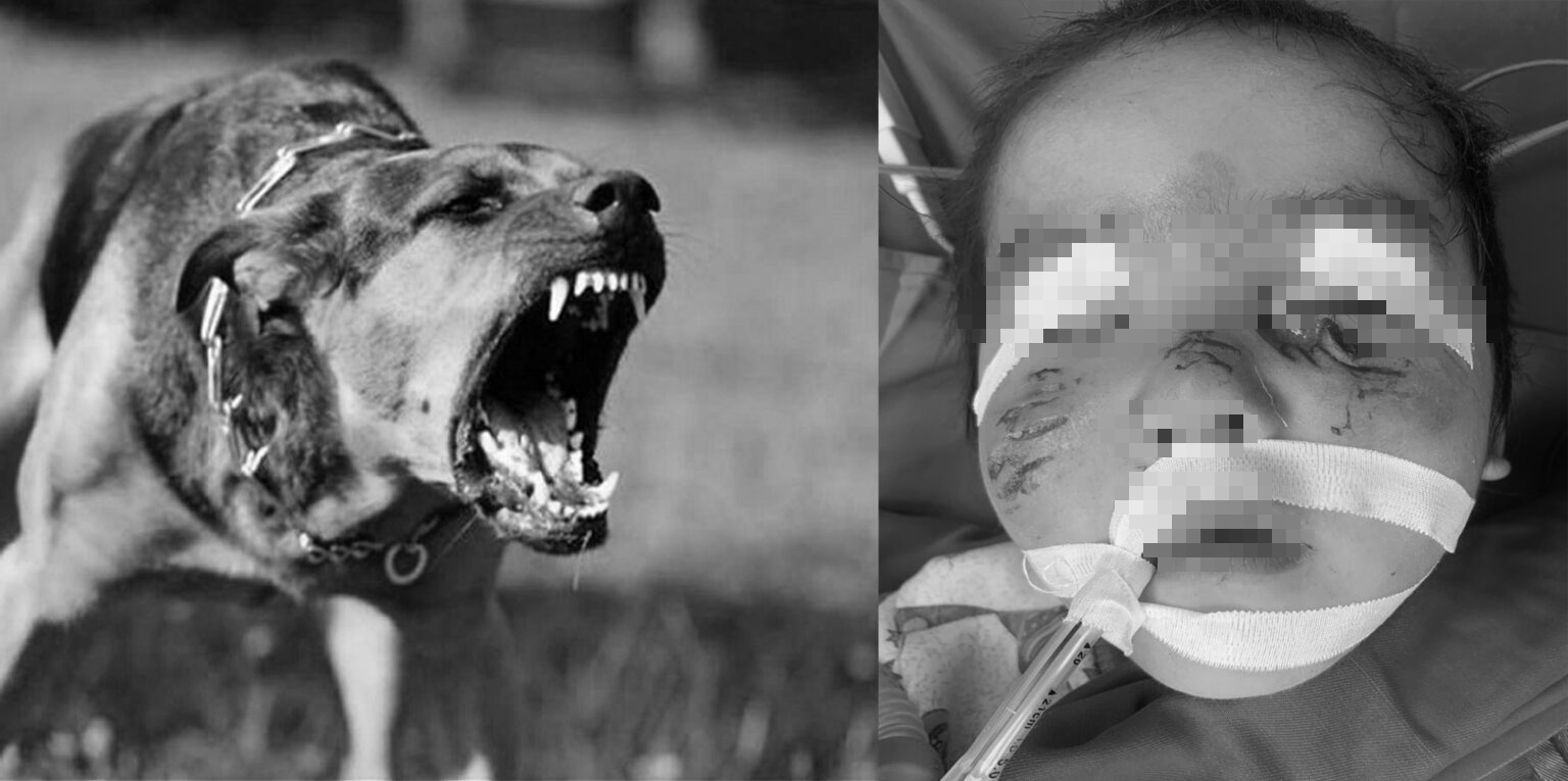 Phú Thọ: Bé trai 3 tuổi bị chó cắn rách mặt khi sang nhà hàng xóm chơi - Ảnh 1