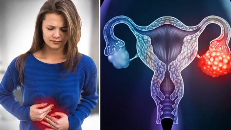 Những dấu hiệu cảnh báo ung thư buồng trứng, phụ nữ tuyệt đối không được bỏ qua kẻo mất mạng - Ảnh 1