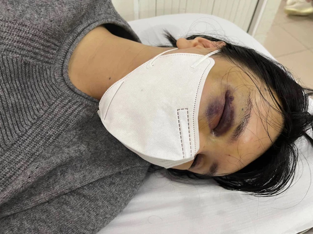 Mẹ chồng siêu mẫu Khả Trang: 'Nó bị chồng đánh thì đau thật lúc ý nhưng xong lại khỏi' - Ảnh 2