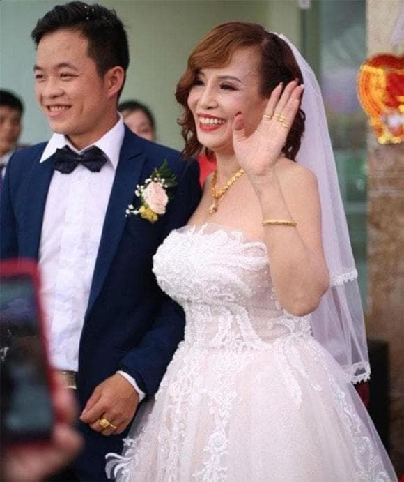 'Cô dâu 62 tuổi' ở Cao Bằng đang chịu biến chứng sau 3 năm phẫu thuật thẩm mỹ: Miệng lệch, mí mắt sụp không thể nhận ra? - Ảnh 1
