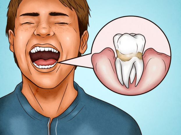 4 dấu hiệu chứng tỏ bạn đang đánh răng quá mạnh - Ảnh 4