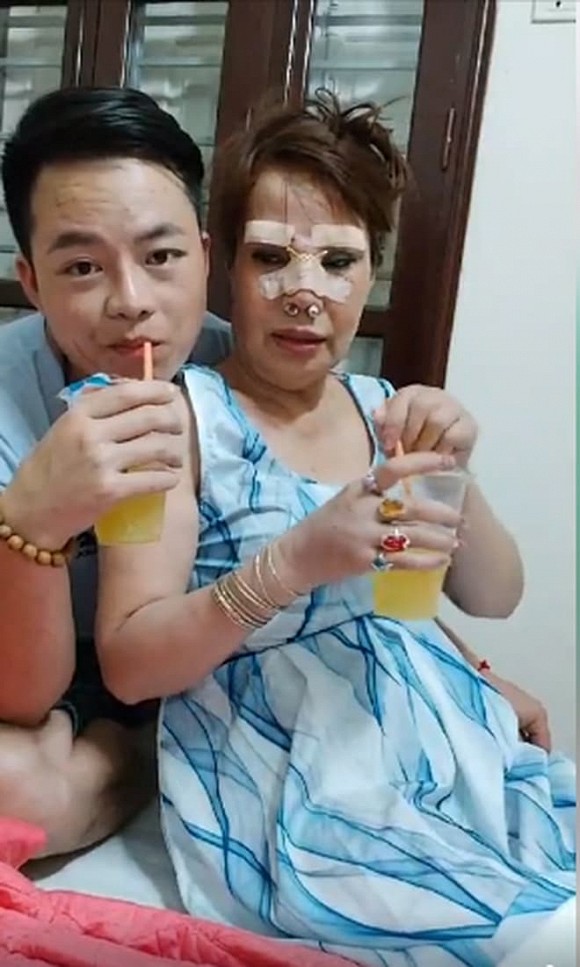 Cô dâu 63 tuổi ở Cao Bằng sau 2 tháng phẫu thuật căng da mặt, diện mạo khiến ai cũng “đồng ý là dao kéo hỏng” - Ảnh 8