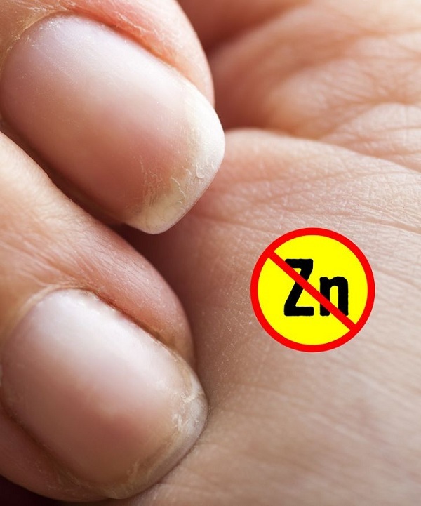 7 dấu hiệu trên bàn tay cảnh báo bất ổn về sức khỏe - Ảnh 6