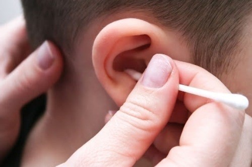 Từ vụ bé 5 tuổi bị thủng màng nhĩ sau khi lấy ráy tai tại nhà, bác sĩ khuyến cáo 4 lưu ý để phòng tránh - Ảnh 1